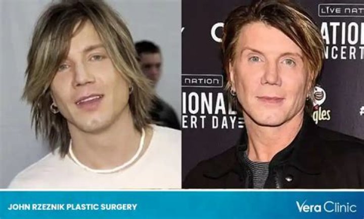 Johnny Rzeznik Plastic Surgery, Did Goo Goo Dolls Lead Singer John Rzeznik Had Plastic Surgery?