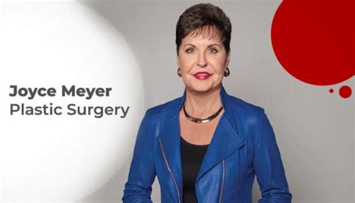 Joyce Meyer's Plastic Surgery Journey: Unveiling The Truth